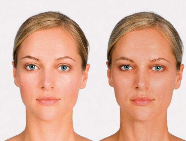 Visage et avant le rajeunissement