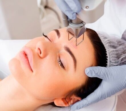 l'essence de la procédure de rajeunissement fractionné de la peau du visage au laser
